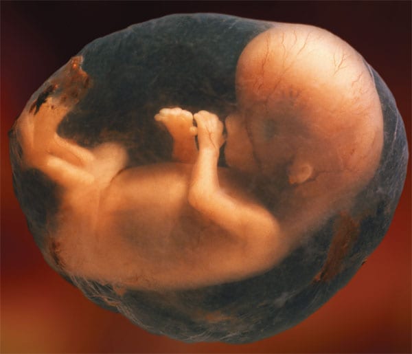 Human Embryo 12 weeks